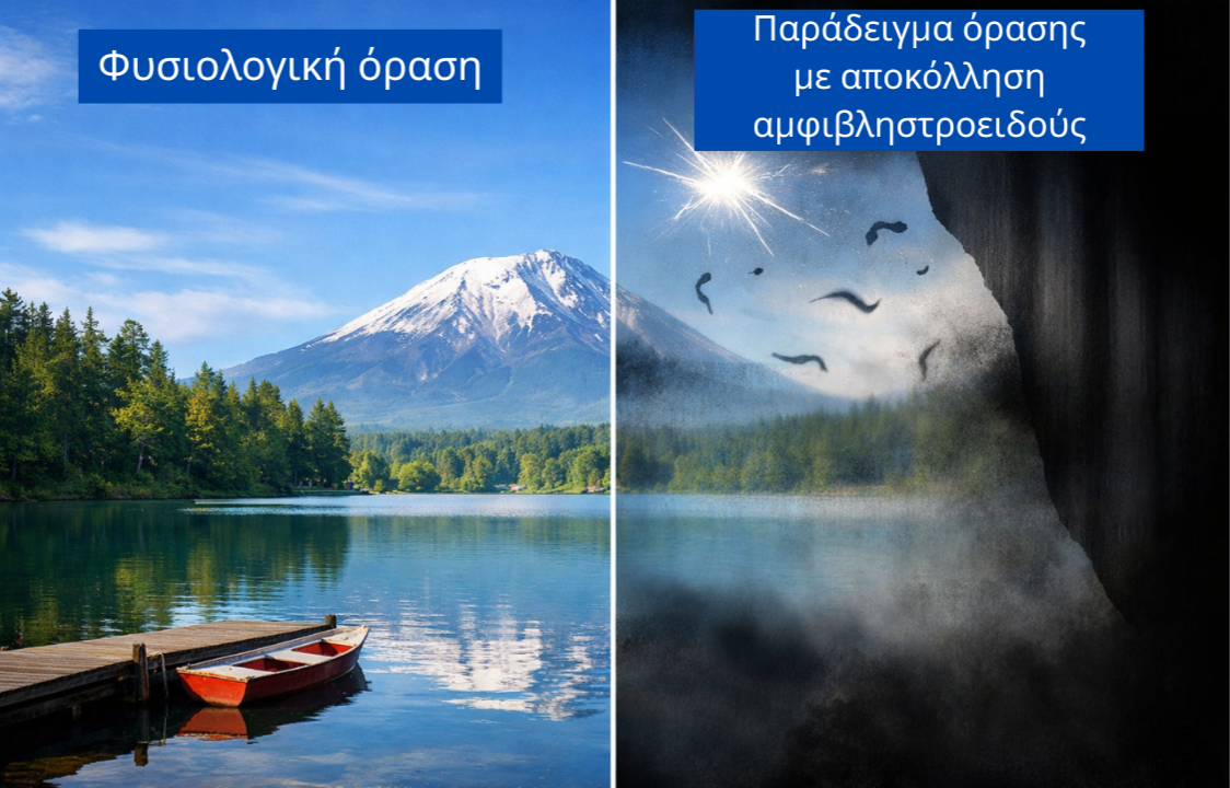 Φυσιολογική όραση (1280 x 720 px)